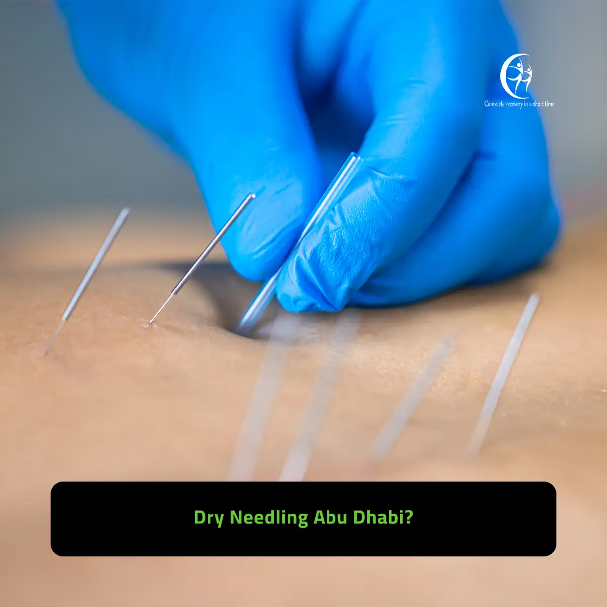 dry needling abu dhabi